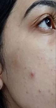 Before - Spotless & Smooth